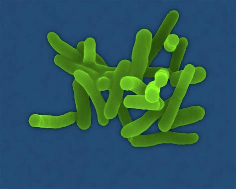 Shigella sonnei .